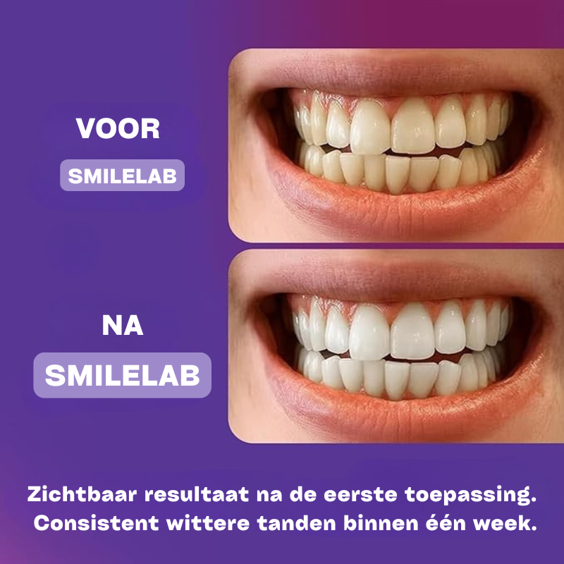 Tandenbleekstrips – PAP+ Peroxidevrij | SmileLab